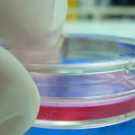 Analisi in vitro